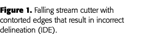 Figure 1  Falling stream cutter with contorted edges that result in incorrect delineation (IDE) 