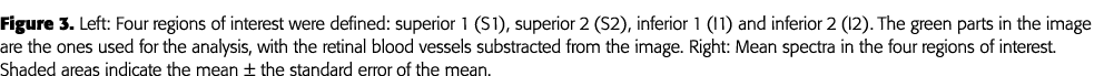Figure 3  Left: Four regions of interest were defined: superior 1 (S1), superior 2 (S2), inferior 1 (I1) and inferior   