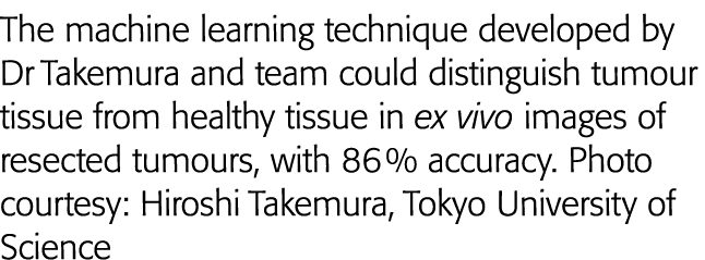 The machine learning technique developed by Dr Takemura and team could distinguish tumour tissue from healthy tissue    