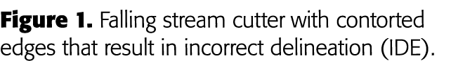 Figure 1  Falling stream cutter with contorted edges that result in incorrect delineation (IDE) 