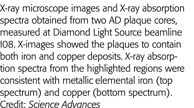 X-ray microscope images and X-ray absorption spectra obtained from two AD plaque cores, measured at Diamond Light Sou   