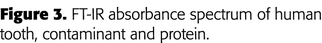 Figure 3  FT-IR absorbance spectrum of human tooth, contaminant and protein 