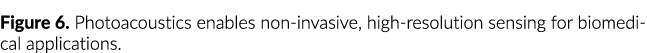 Figure 6  Photoacoustics enables non-invasive, high-resolution sensing for biomedical applications 