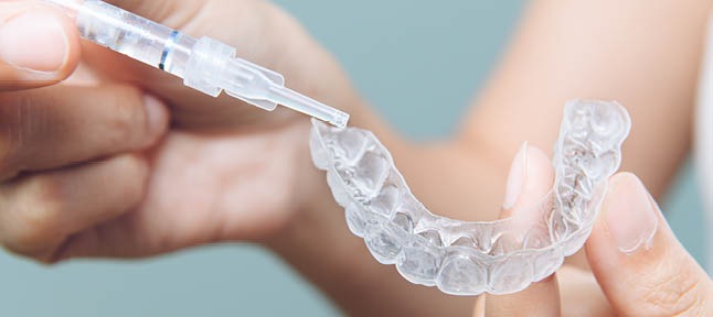 Tooth whitening gel being applied to a tooth mold in preparation for being placed in the mouth 