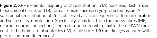 Figure 2  XRF elemental mapping of Zn distribution in (A) non-fixed flash frozen hippocampal tissue, and (B) formalin   