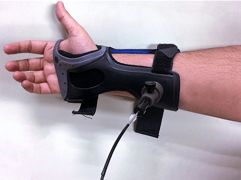 Will Raman be the solution to noninvasive blood glucose testing? Spectroscopy Europe/World