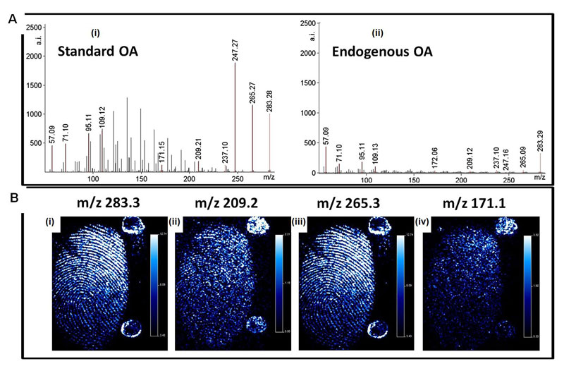 Matrixassisted laser desorption ionisation tandem mass spectrometry