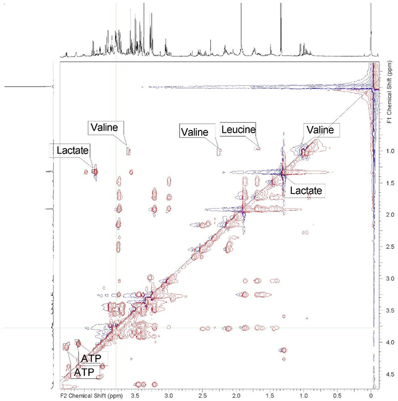 2D NMR spectra