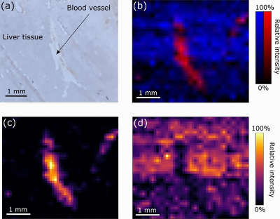 Light and mass spectromert imaging of tissue samples