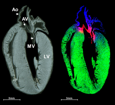 Mass spectrometry image of rat heart