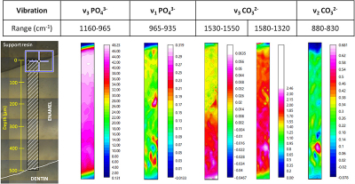 Chemical distribution of carbonates and phosphates in a tooth by band vibration.